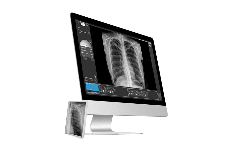 Avanse, DR imaging software