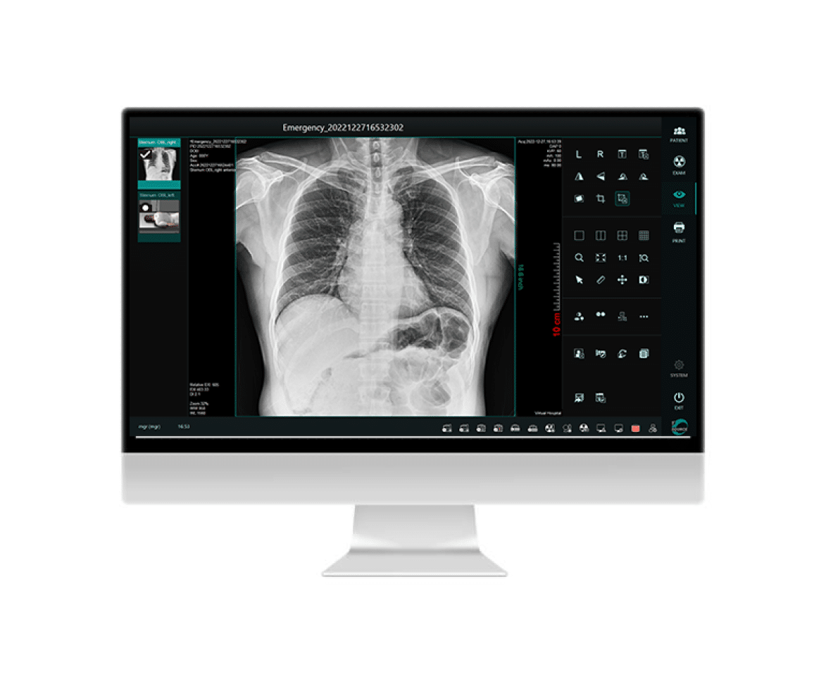 FUJIFILM DR Panels - Radiology Imaging Solutions